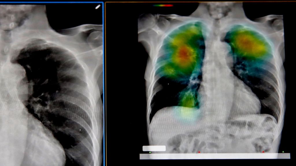 Doctors may soon be able to diagnose diseases before you ever feel sick