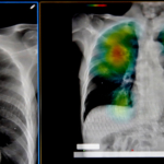 Doctors may soon be able to diagnose diseases before you ever feel sick