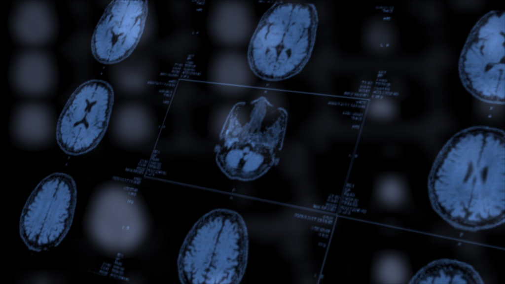 This ‘healthy’ ingredient you are probably eating could give you a stroke