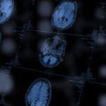 This ‘healthy’ ingredient you are probably eating could give you a stroke
